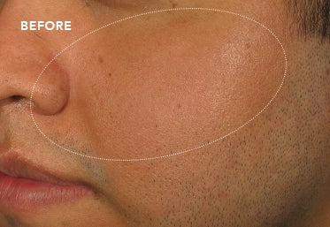 Before image